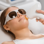 7 Simple Ways The Pros Use to Promote Laser Hair Removal Las Vegas