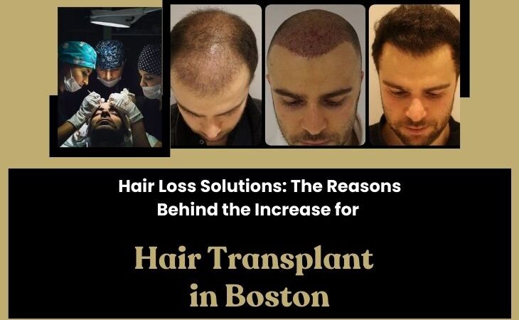 Hair-Loss-Solutions-The-Reasons-Behind-the-Increase-for-Hair-Transplant-in-Boston