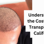 hair transplant cost in california