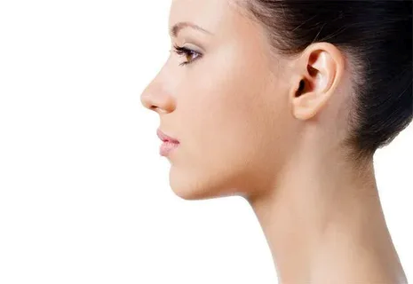 Chin liposuction in Dubai