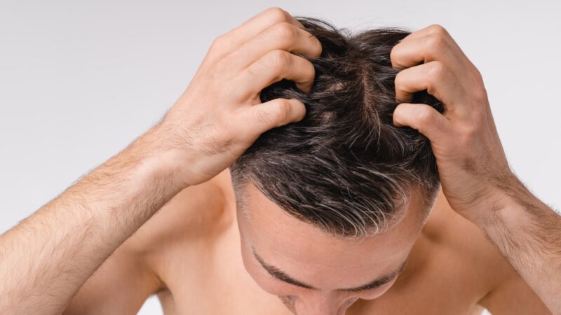 Hair Loss Treatment in Dubai