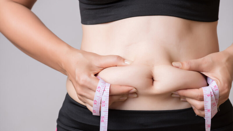 Liposuction Surgery in Dubai