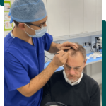 hair transplant cost London