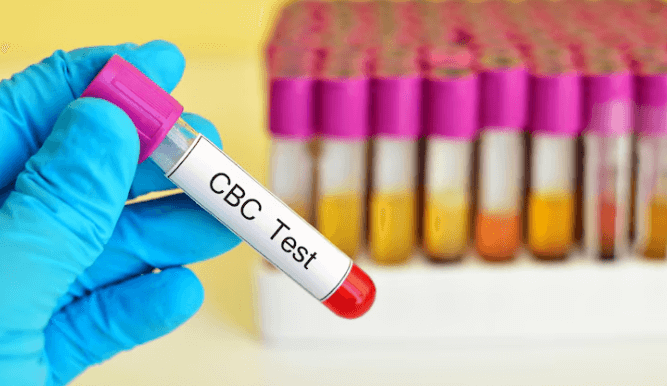 CBC Test in Delhi