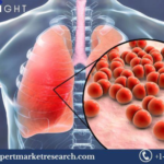 Pathogen Reduction Systems Market