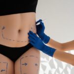 Thigh Lift Surgery-Medical Visa