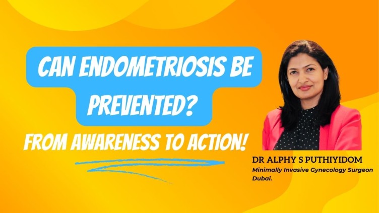 Endometriosis Expert in dubai