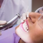 Best teeth cleaning in Dubai