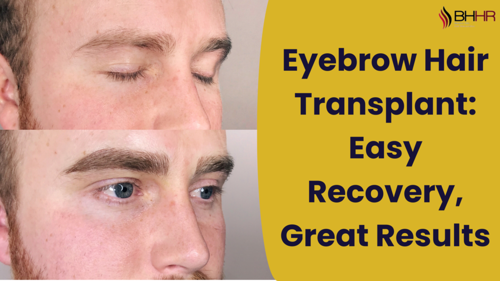 eyebrow hair transplant