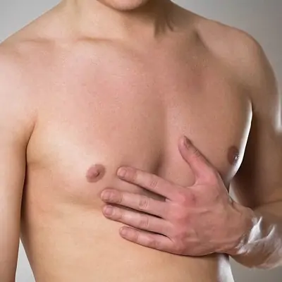 How to Prepare for a Smooth Gynecomastia Surgery Experience in Dubai