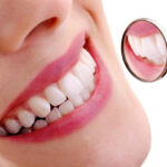 Achieving a Brighter Smile with Teeth Whitening and Sedation Dentistry in Crowley, Texas