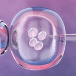 ivf