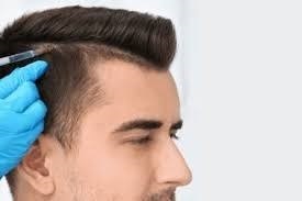 Achieve Youthful Hair Again with Hair Transplant in Dubai