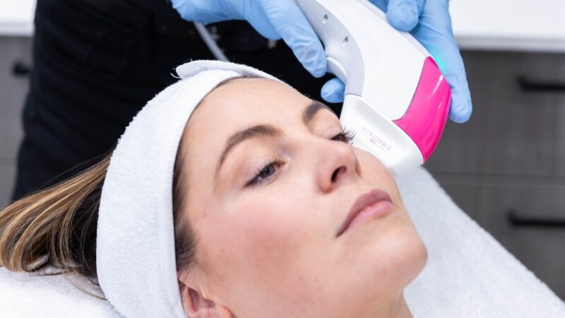 Top 10 benefits of HIFU face lifting for a youthful look