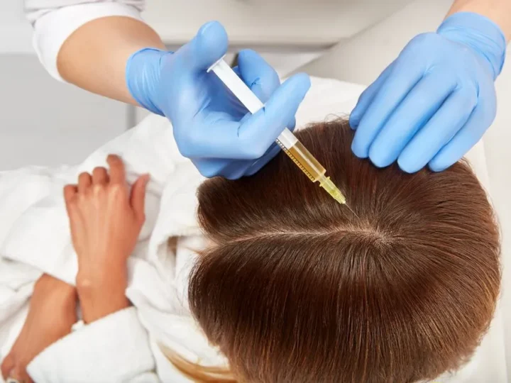 Hair Plasma Therapy: Boost Your Hair’s Health Naturally