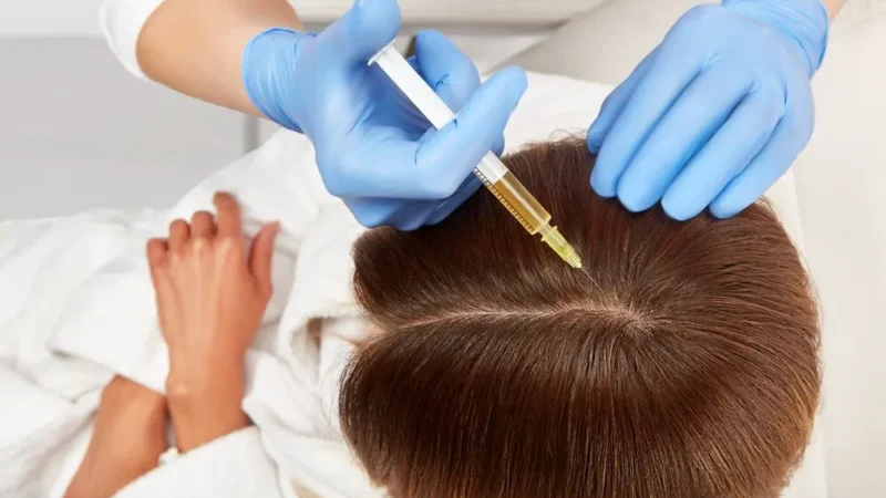 Hair Plasma Therapy: Boost Your Hair’s Health Naturally