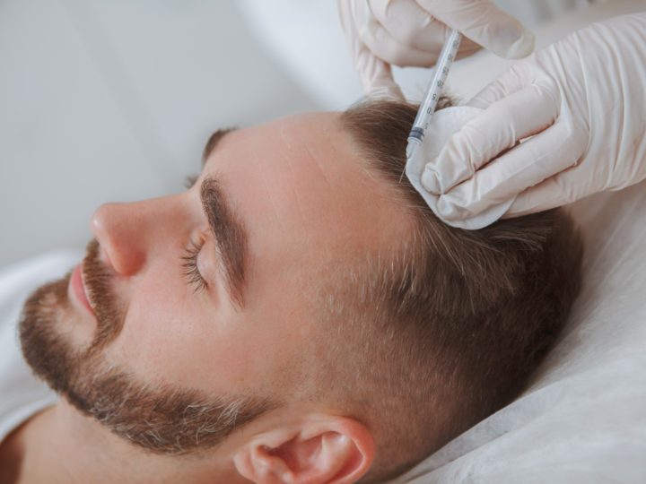 How Does Platelet-Rich Plasma Therapy Work for Scalp Rejuvenation?