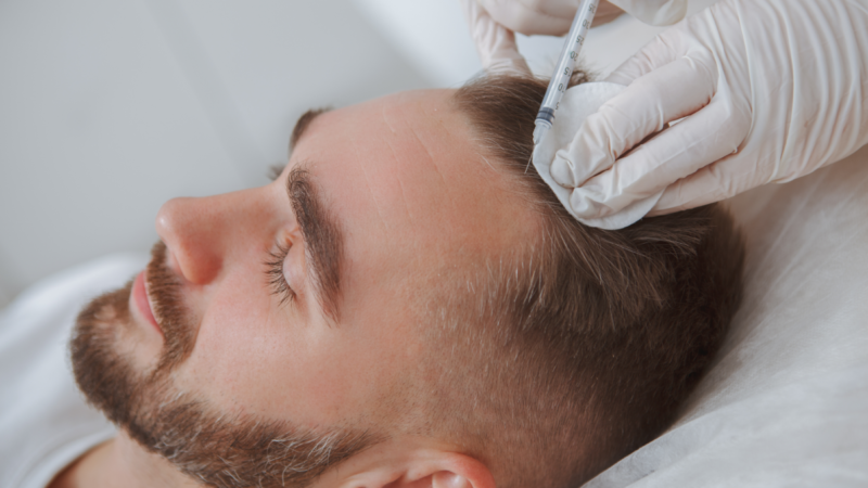 How Does Platelet-Rich Plasma Therapy Work for Scalp Rejuvenation?