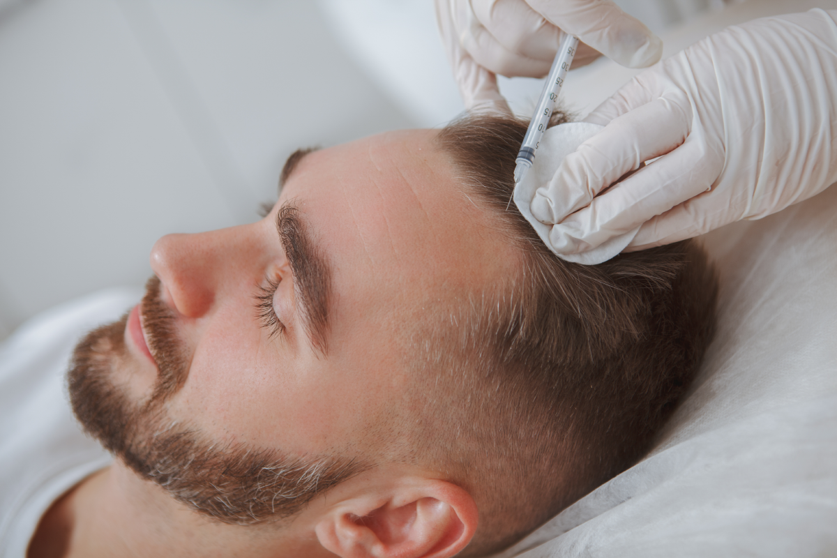 How Does Platelet-Rich Plasma Therapy Work for Scalp Rejuvenation?