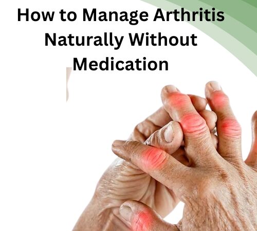 How to Manage Arthritis Naturally Without Medication