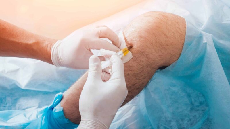 Can a Knee Pain Specialist Help Avoid Surgery?